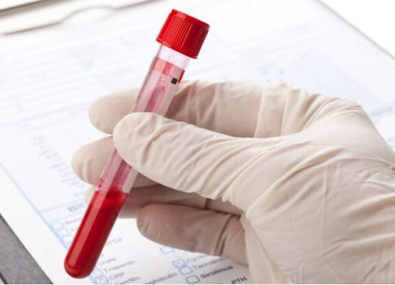 Laboratoryjne metody diagnostyczne pozwalają zidentyfikować patologiczną mikroflorę lub wirus